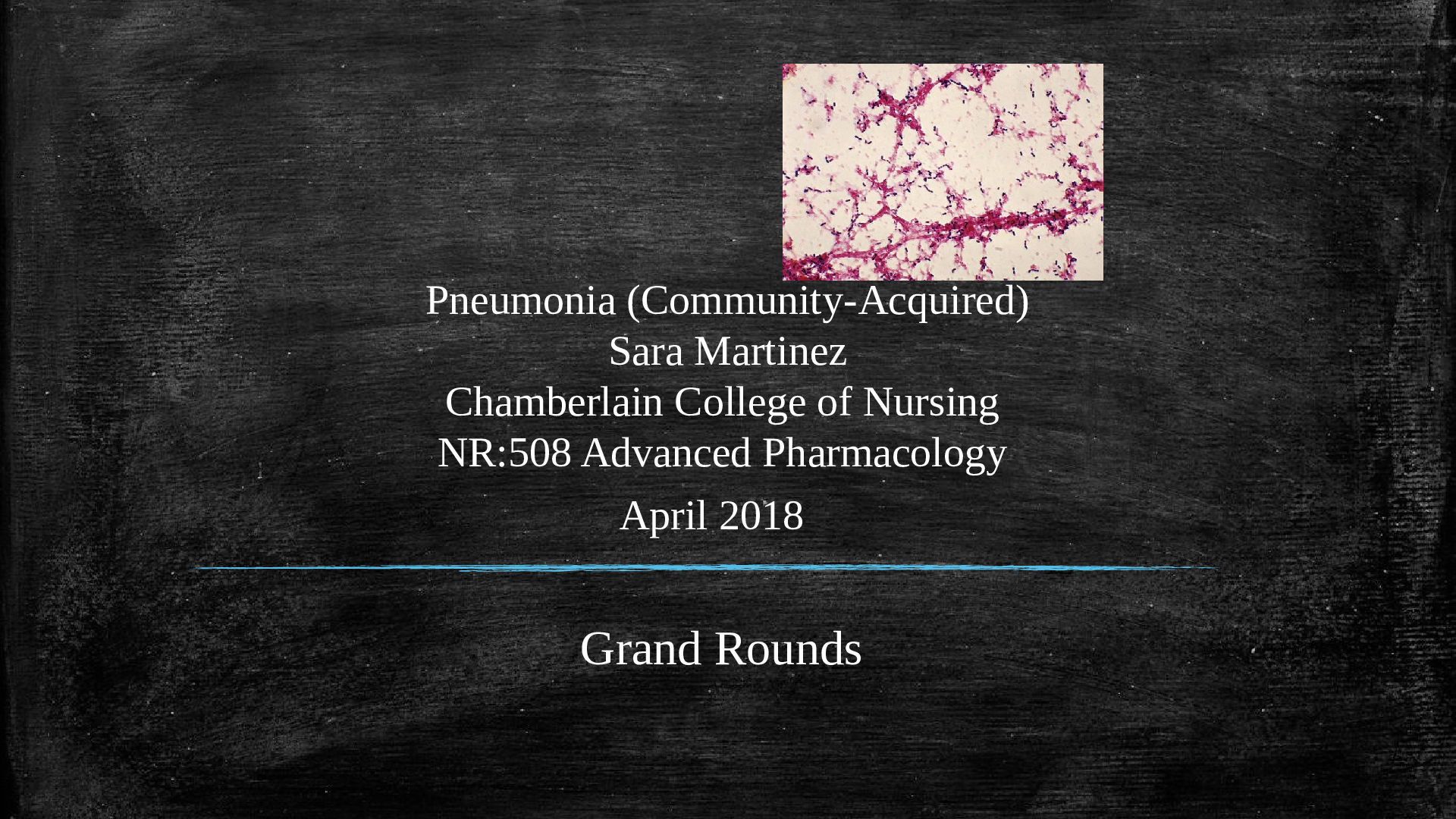 NR508 Advanced Pharmacology Pneumonia (Community-Acquired) by Sara Martinez Chamberlain College of Nursing